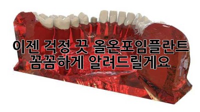 이젠 걱정 끗! 올온포임플란트, 꼼꼼하게 알려드릴게요! ✨